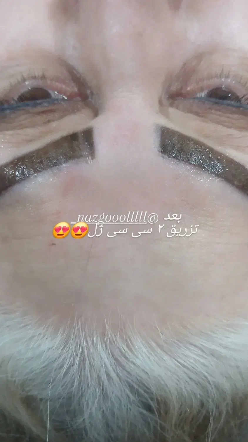 خدمات ژل و بوتاکس|خدمات آرایشگری و زیبایی|بهبهان, |دیوار