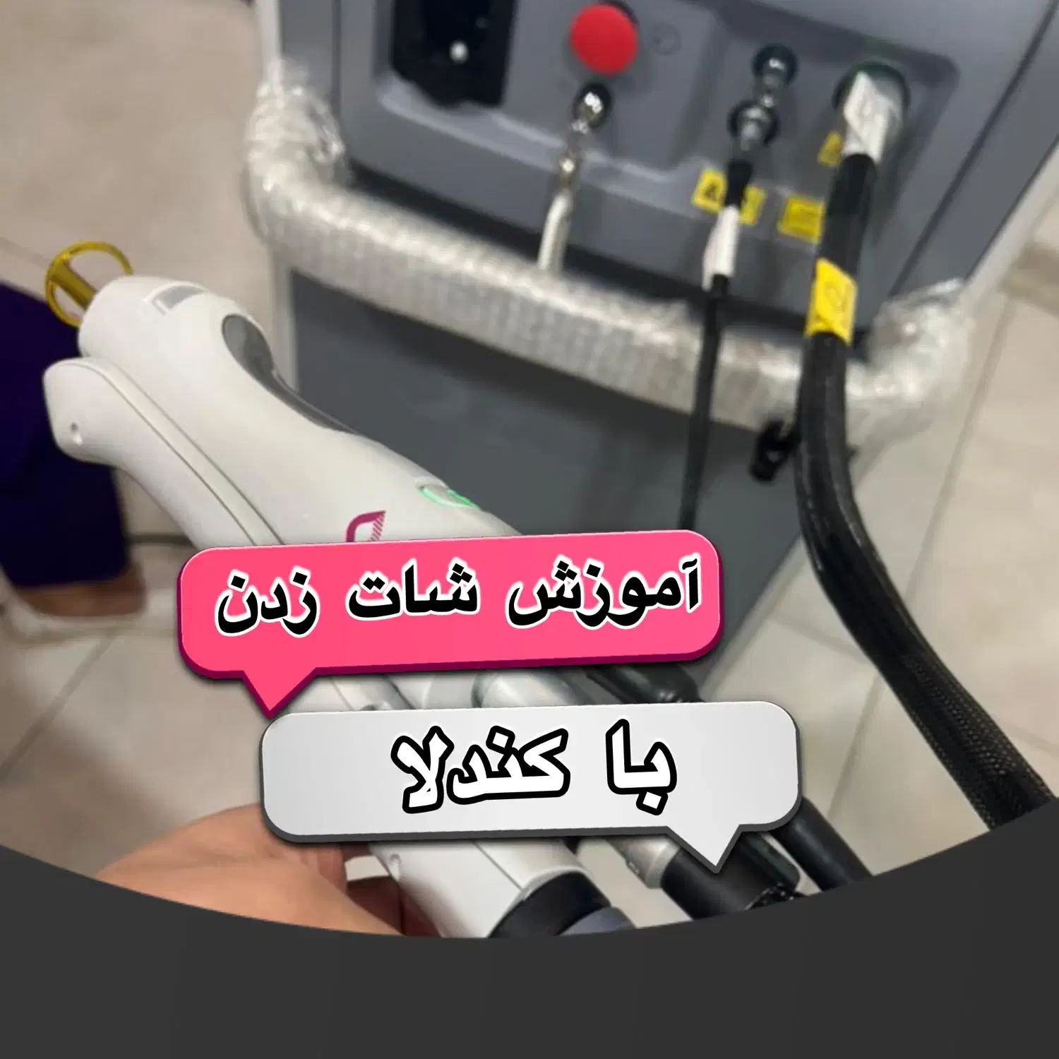 آموزش اپراتوری لیزر موهای زائد با دستگاه کندلا|خدمات آموزشی|پاکدشت, پاکدشت (مامازند)|دیوار
