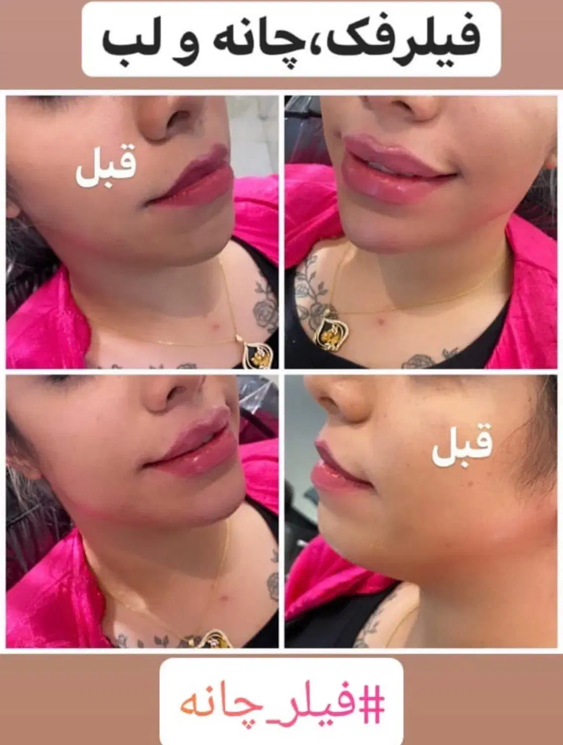 آموزش و خدمات ژل و بوتاکس|خدمات آرایشگری و زیبایی|زابل, |دیوار