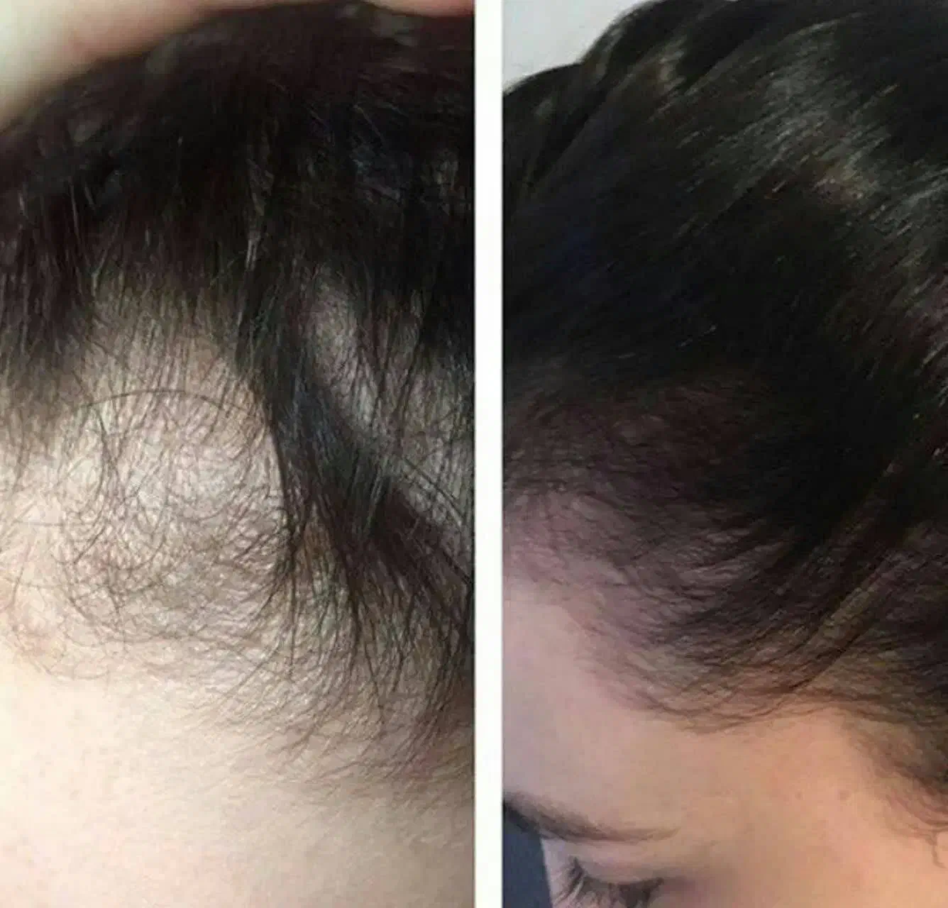 رفع ریزش مو|فعالیت داوطلبانه|شهر بابک, |دیوار