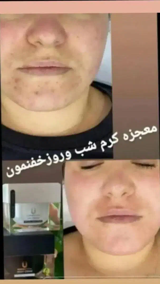 کرم روز شب لاکچری کوین|آرایشی، بهداشتی، درمانی|ایرانشهر, |دیوار