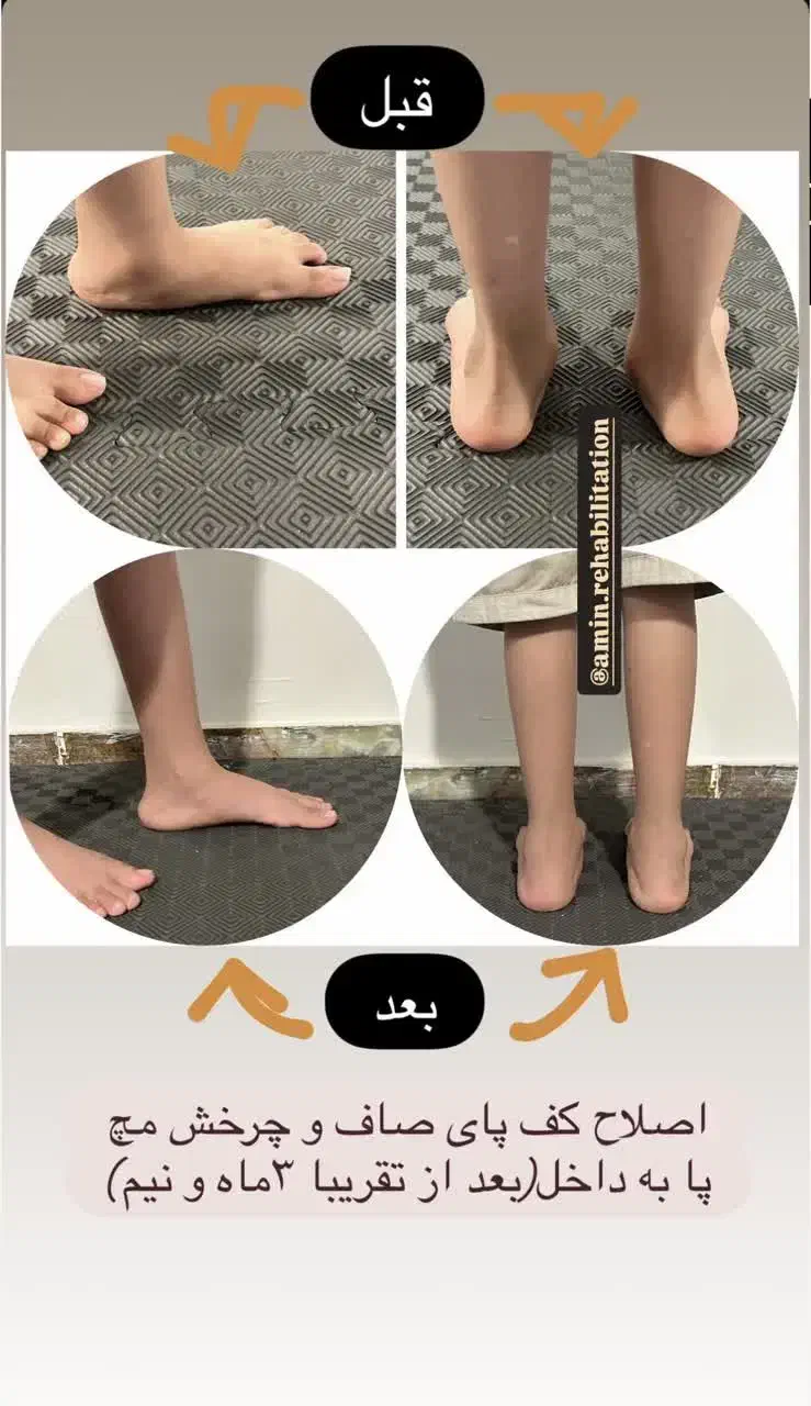 اموزش حرکات اصلاحی (حرکات اصلاحی. کمر درد مزمن)|خدمات آموزشی|کرمان, |دیوار