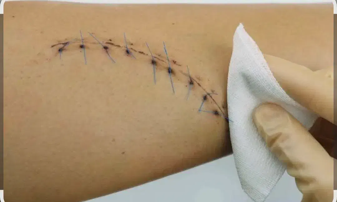 تزریقات و بخیه زدن در منزل خودتان پذیرفته میشود|خدمات آرایشگری و زیبایی|هامون, |دیوار