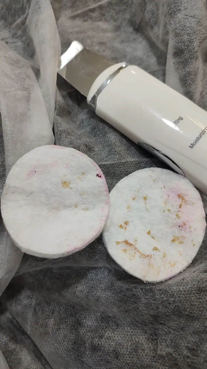 پاکسازی تخصصی صورت|خدمات آرایشگری و زیبایی|محمدشهر, محمدشهر|دیوار