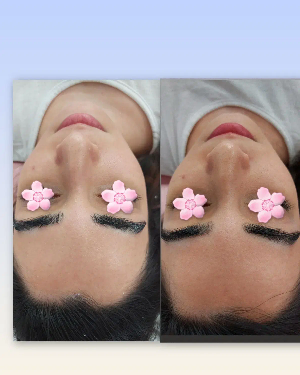 فیشال تخصصی پوست|خدمات آرایشگری و زیبایی|محمدشهر, محمدشهر|دیوار