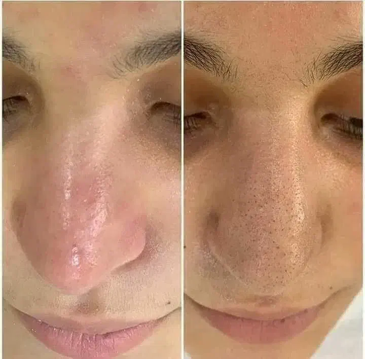 50% تخفیف خدمات تخصصی پوست و مو ۲۹۸|خدمات آرایشگری و زیبایی|مشهد, آزادشهر|دیوار