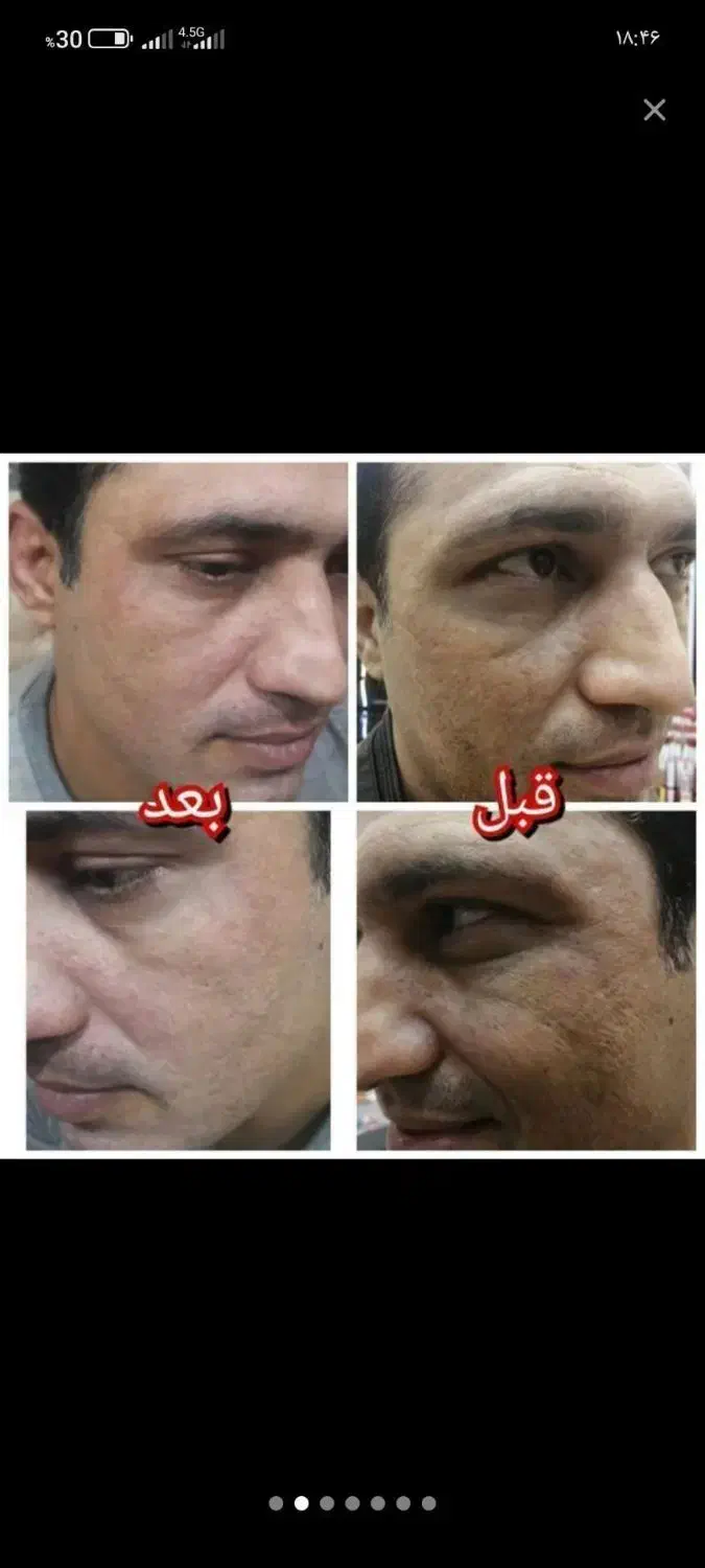 بینظیر|آرایشی، بهداشتی، درمانی|خرم‌آباد, |دیوار