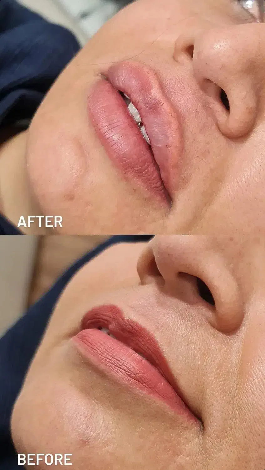 بلک فرایدی زیبایی کلینیک دکتر محمودی|خدمات آرایشگری و زیبایی|کرمان, |دیوار