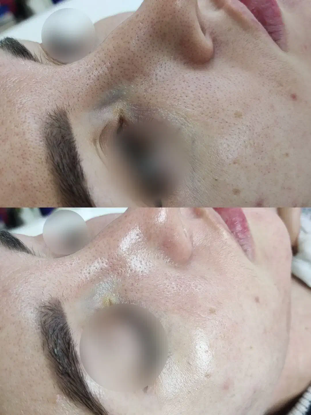 زیبایی صورتت با ما /مزونیدلینگ و PRP صورت|خدمات آرایشگری و زیبایی|دوگنبدان, |دیوار