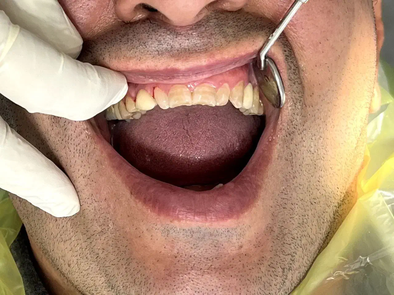 خدمات دندان پزشکی با متناسب شرایط و بودجه شما|خدمات آرایشگری و زیبایی|رودبار, |دیوار