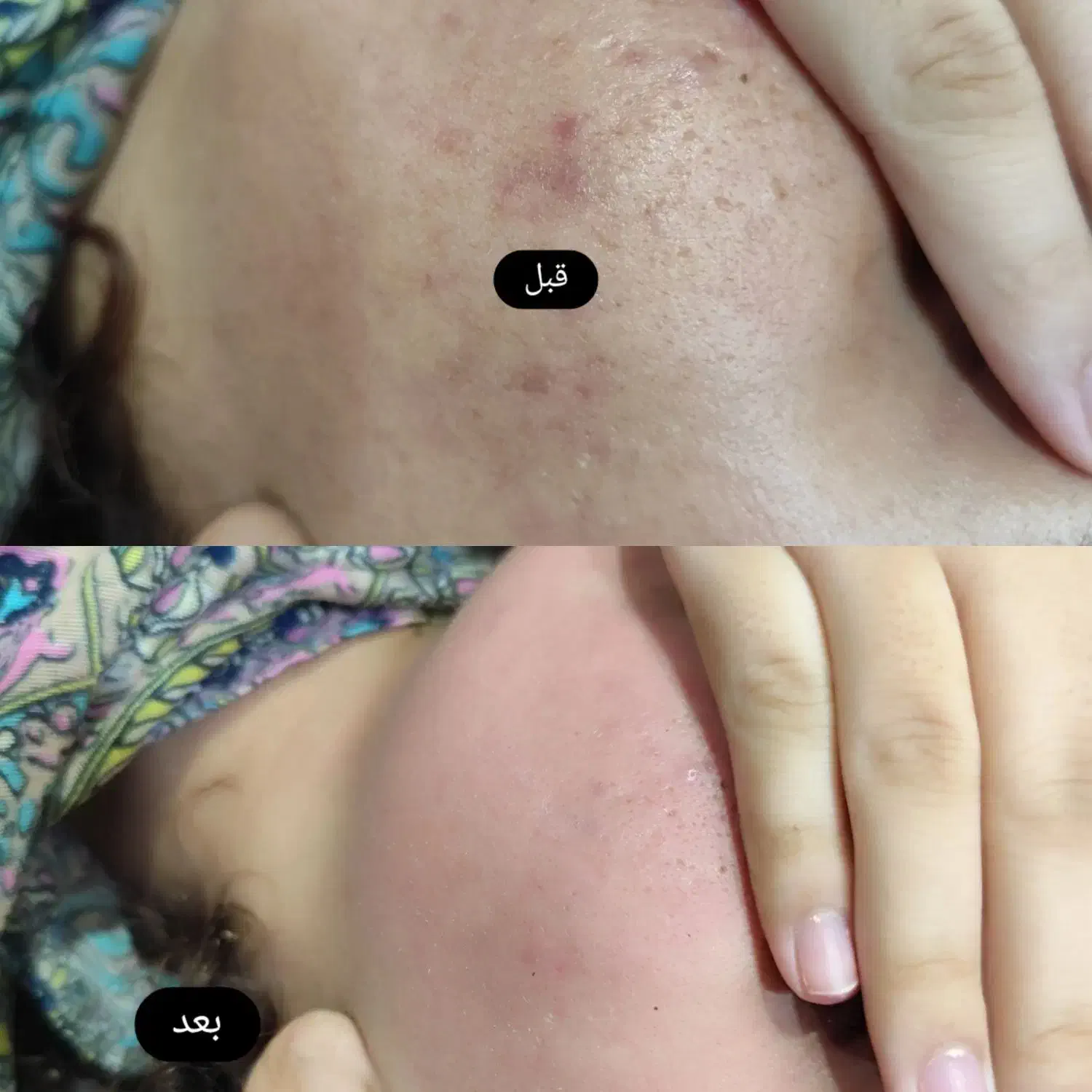 پاکسازی صورت مطب دکتر آذین اسکندری|خدمات آرایشگری و زیبایی|دوگنبدان, |دیوار