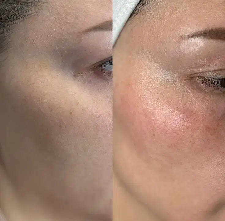 خدمات تخصصی cipپوست کره ای|خدمات آرایشگری و زیبایی|علیآباد کتول, |دیوار