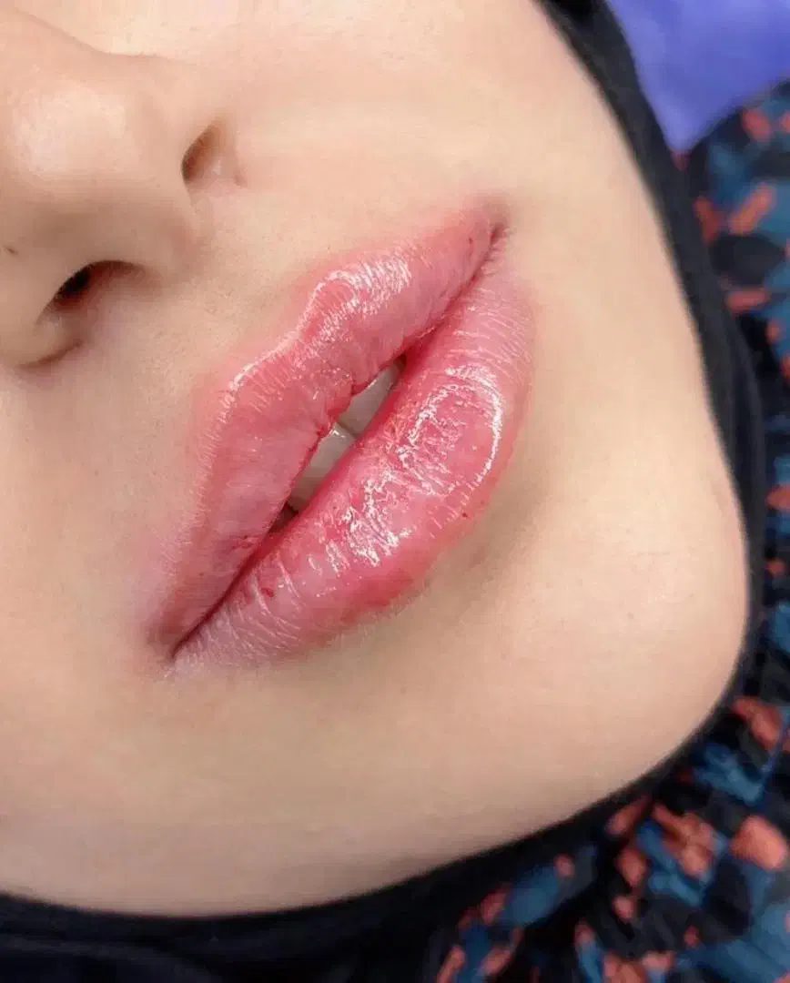 آموزش ژل و بوتاکس|خدمات آموزشی|شیراز, زرهی|دیوار