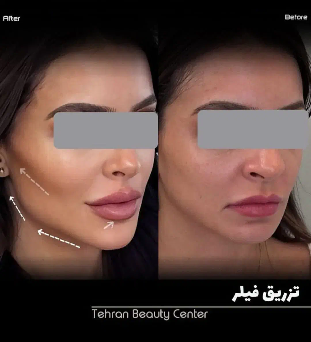 کلینیک فوق تخصصی/کاشت مو / ابرو|خدمات آرایشگری و زیبایی|زاهدان, |دیوار