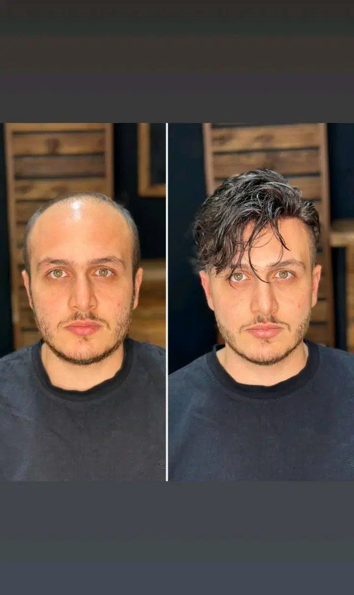 نصب انواع پروتز مو طبیعی، فروش چسب و ریمور|خدمات آرایشگری و زیبایی|سبزوار, ولیعصر (نجار آباد)|دیوار