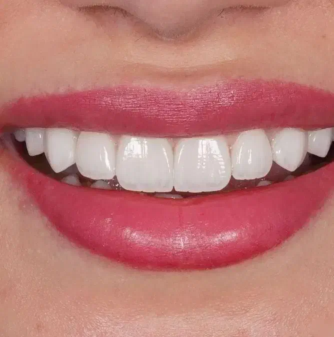 دندانپزشک جهت همکاری|استخدام درمانی، زیبایی، بهداشتی|تبریز, |دیوار