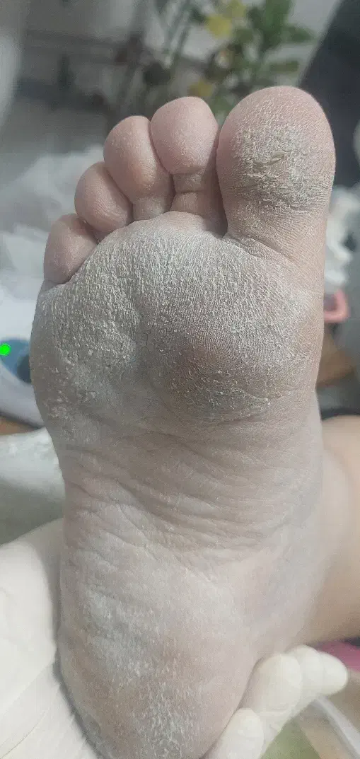 کفسابی درمانی فقط 450 در سالن زیبایی سمیرا محمدی|خدمات آرایشگری و زیبایی|اصفهان, نقش جهان|دیوار