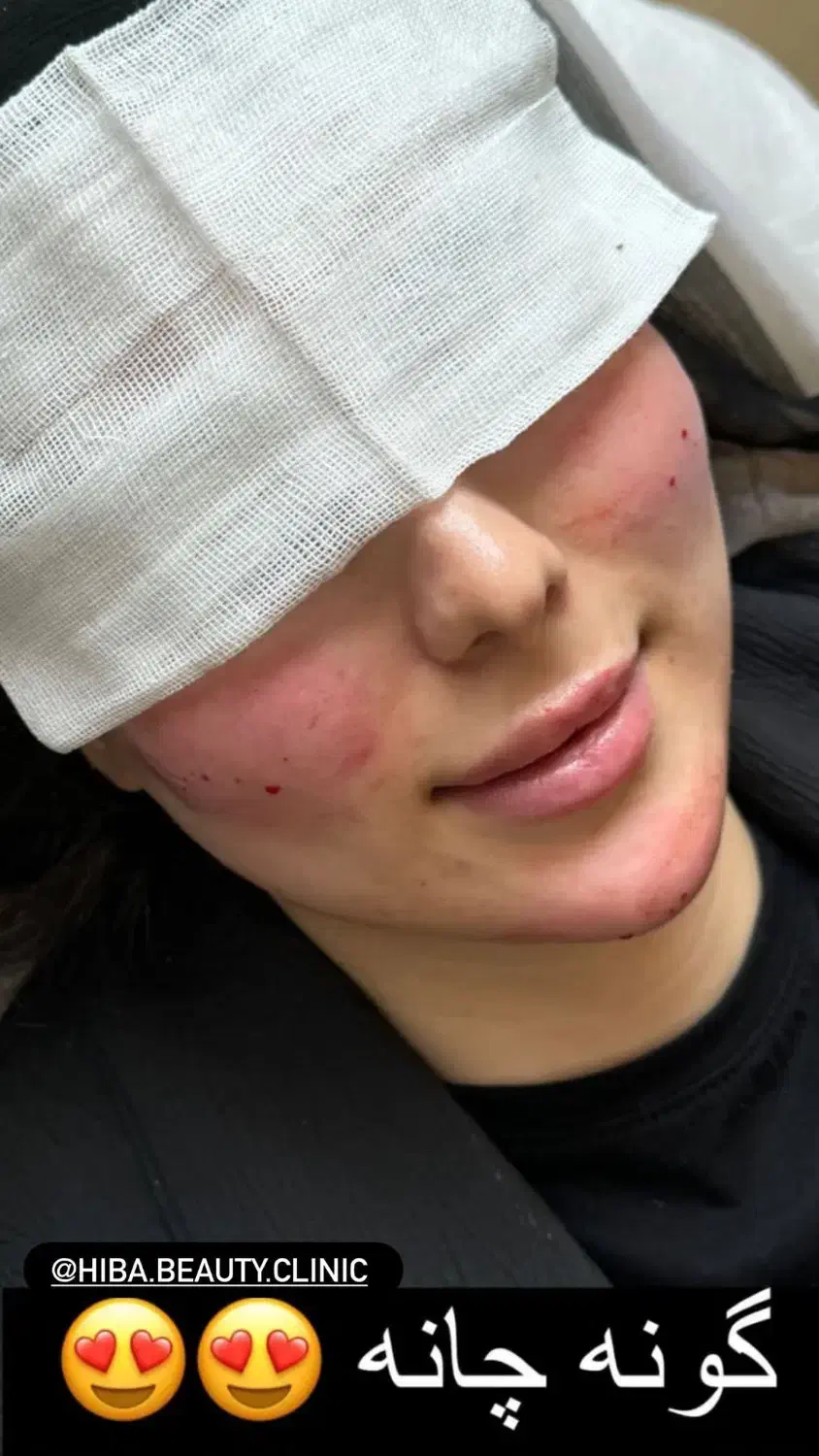 استخدام اپراتور لیزر در کلینیک زیبایی|استخدام درمانی، زیبایی، بهداشتی|برازجان, |دیوار