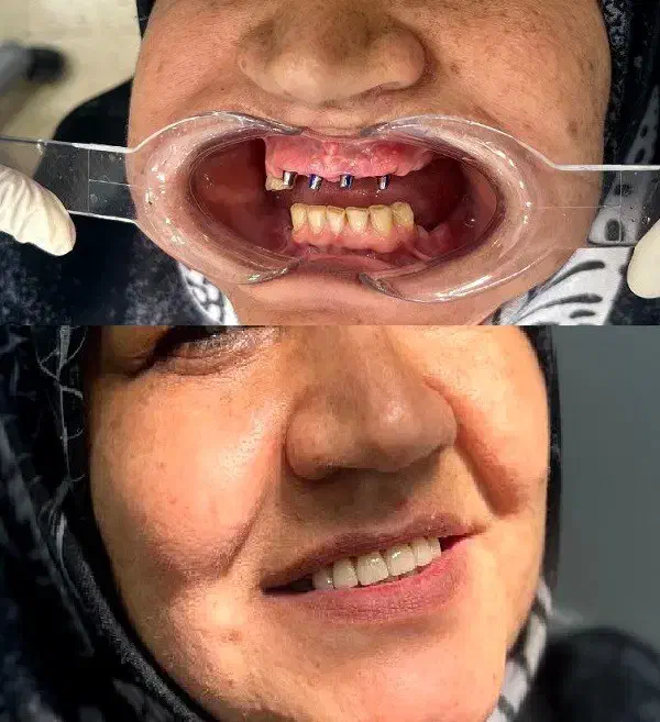 اقساط استثنایی دندانپزشکی همه امور دندان پزشکی|خدمات آرایشگری و زیبایی|اصفهان, دشتستان|دیوار