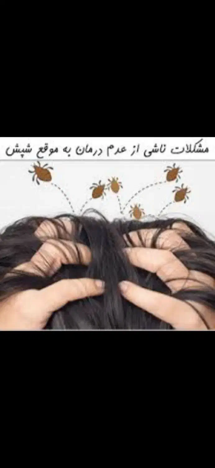 شامپو شپش و تخم شپشصد در صد تضمینی|آرایشی، بهداشتی، درمانی|خرمدره, |دیوار