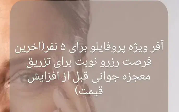 نیازمند مدل جهت فیلر لب|خدمات آرایشگری و زیبایی|تهران, قیطریه|دیوار