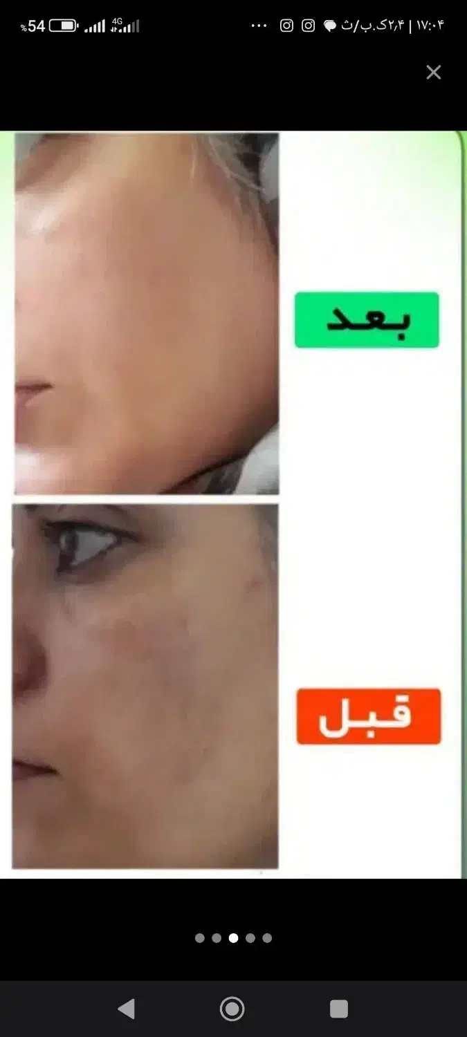 درمان پوست ومو|آرایشی، بهداشتی، درمانی|نهبندان, |دیوار