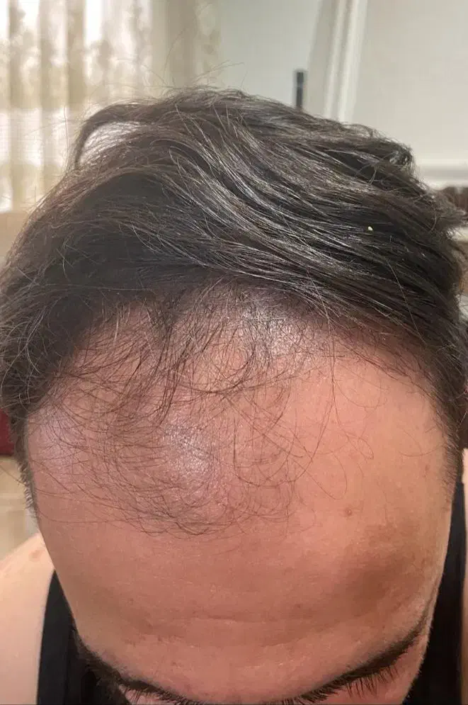 کاشت ابرو وکاشت مو فقط 15 میلیون|خدمات آرایشگری و زیبایی|تربتحیدریه, مسجد جامع|دیوار