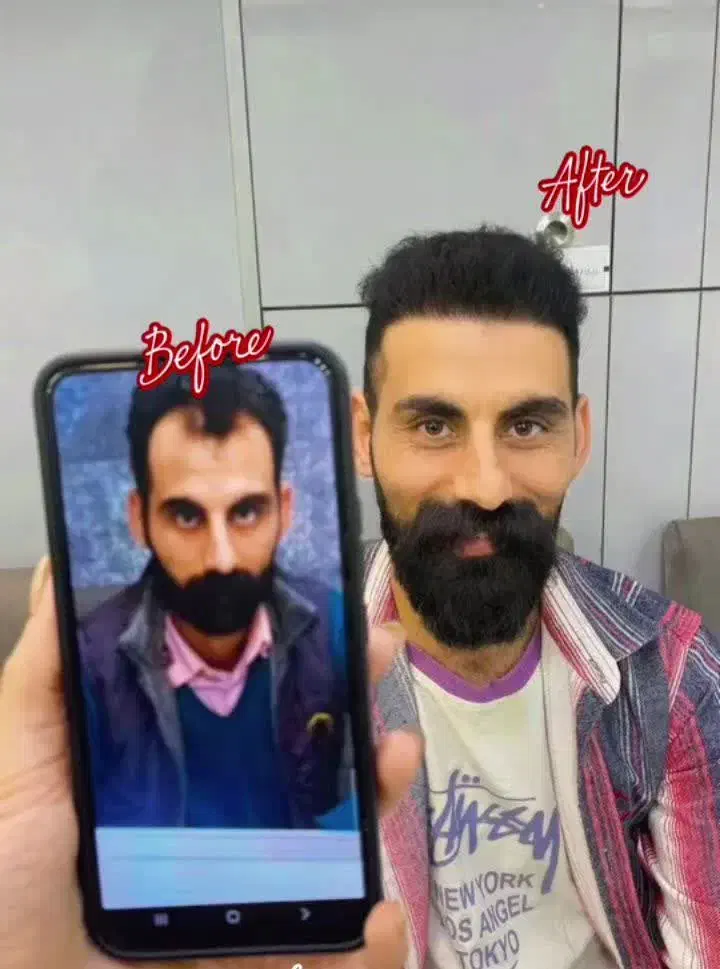 kasht|خدمات آرایشگری و زیبایی|همدان, |دیوار