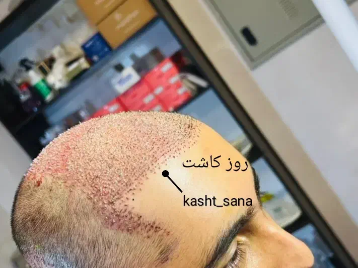 جشنواره‌پایزه‌کاشت‌موریش‌وابروشیرازی‌دراردبیل‌قساط|خدمات آرایشگری و زیبایی|اردبیل, |دیوار