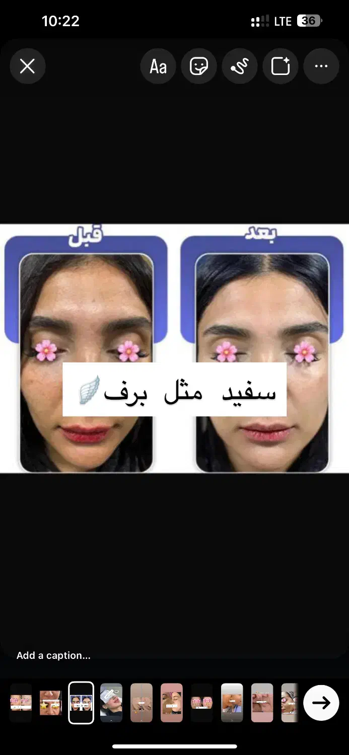 گلوتاتیون/درمان پیسی/روشن کننده کل صورت وبدن|خدمات آرایشگری و زیبایی|اهواز, کیانپارس |دیوار