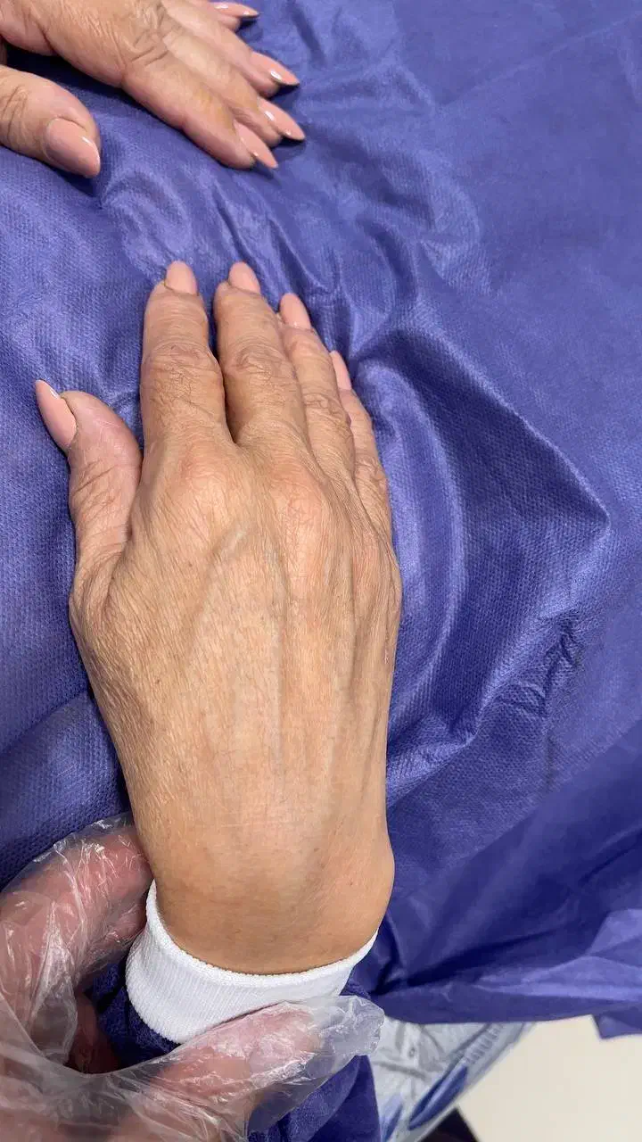 فرمدهی ساعتشنی بدن ساکشن و تزریق چرب|خدمات آرایشگری و زیبایی|رفسنجان, |دیوار