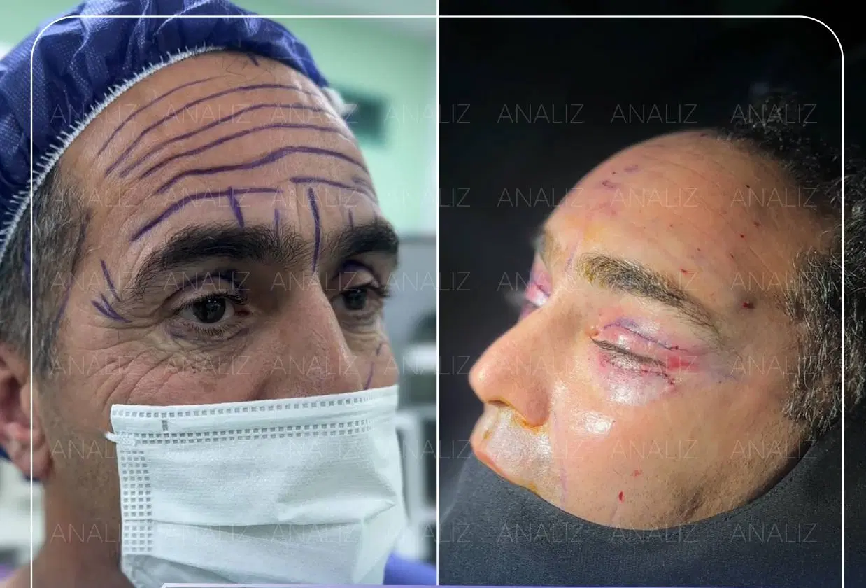 جشنواره عمل بینی ، لیفت شقیقه، اندسکوپیک، مید فیس|خدمات زیبایی و سلامت|شیراز, ستارخان|دیوار