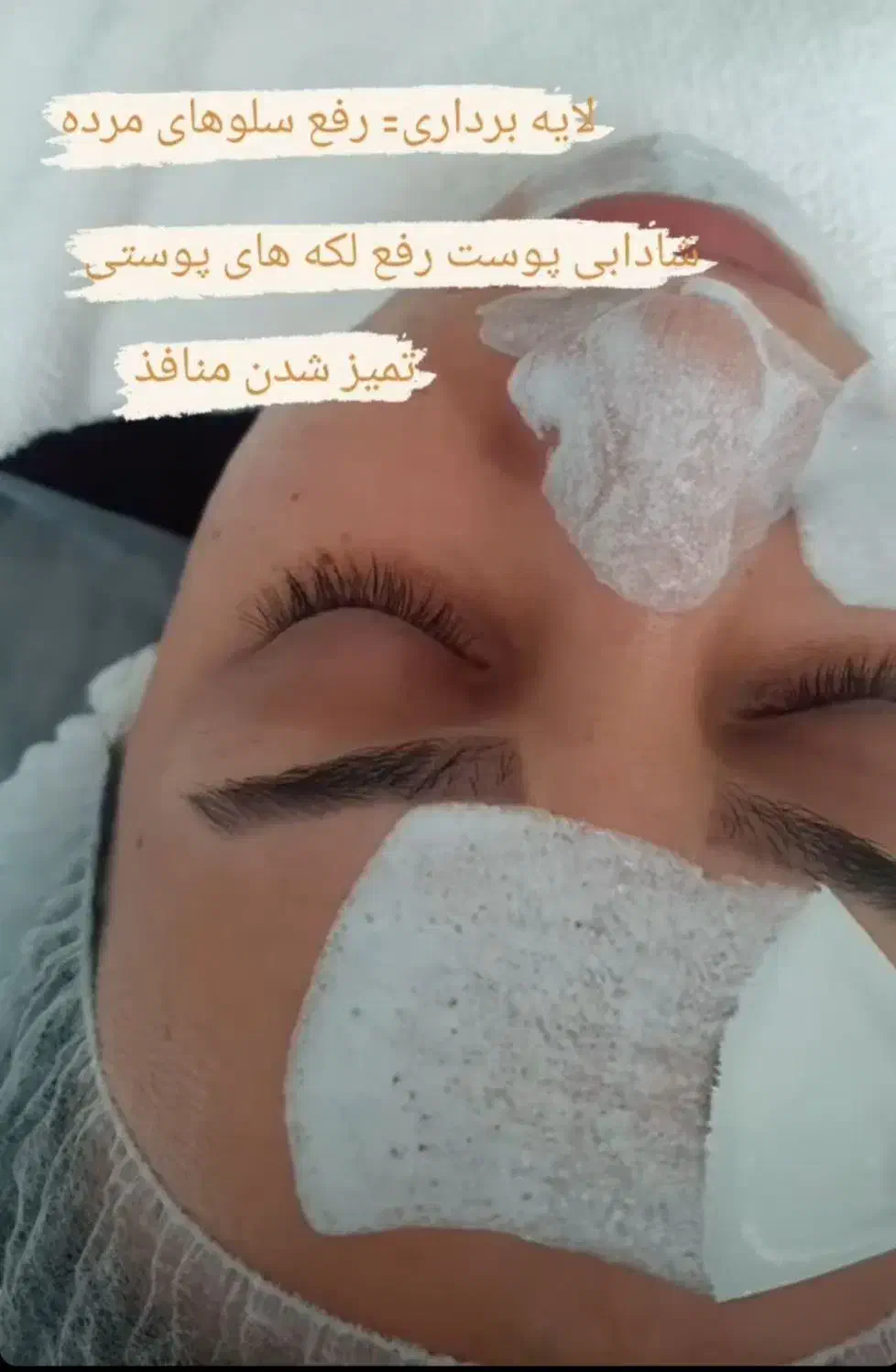 کلیه خدمات زیبایی و فیشال در کلینیک زیبایی میراکل|خدمات آرایشگری و زیبایی|لاهیجان, قیام|دیوار