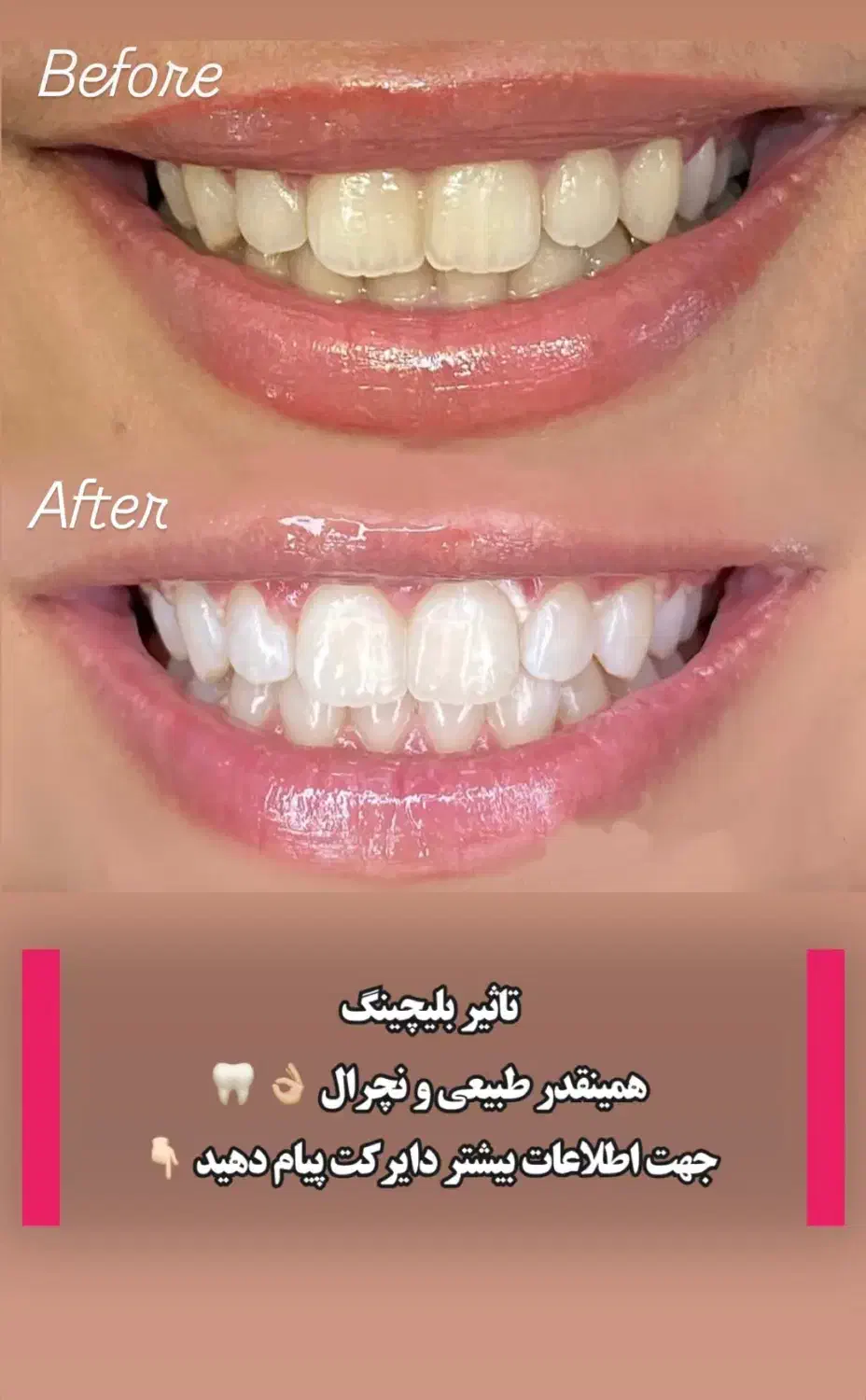 تخفیف خدمات دندانپزشکی|خدمات آرایشگری و زیبایی|رشت, گلسار|دیوار