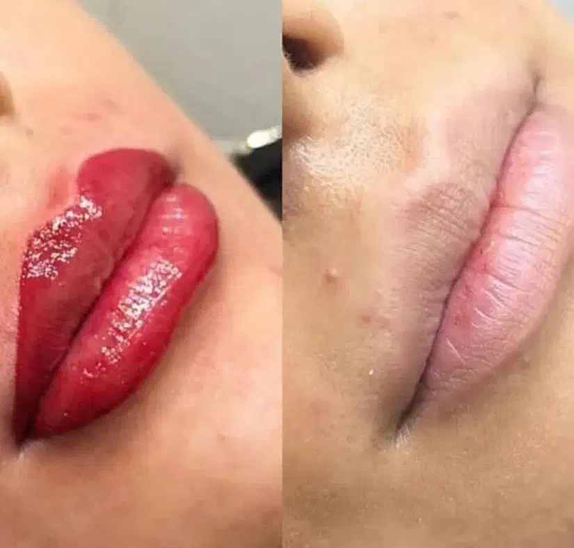 خدمات آرایش دائم و ریمو|خدمات آرایشگری و زیبایی|اردبیل, |دیوار