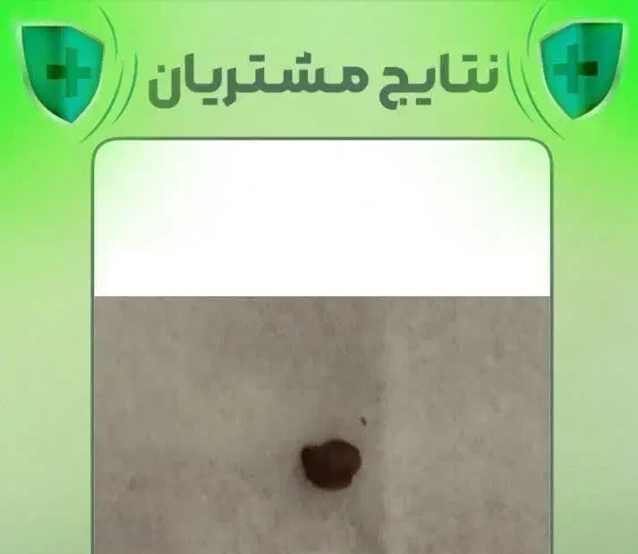 یه روغن گیاهی و خوردنی برای دفع سنگکلیه|خوردنی و آشامیدنی|شادگان, |دیوار