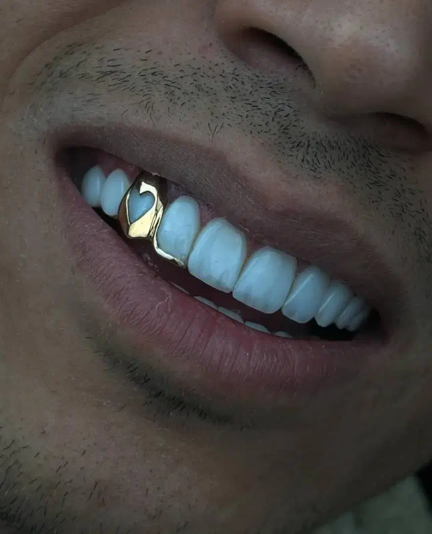 کامپوزیت|خدمات آرایشگری و زیبایی|تهران, فدک|دیوار