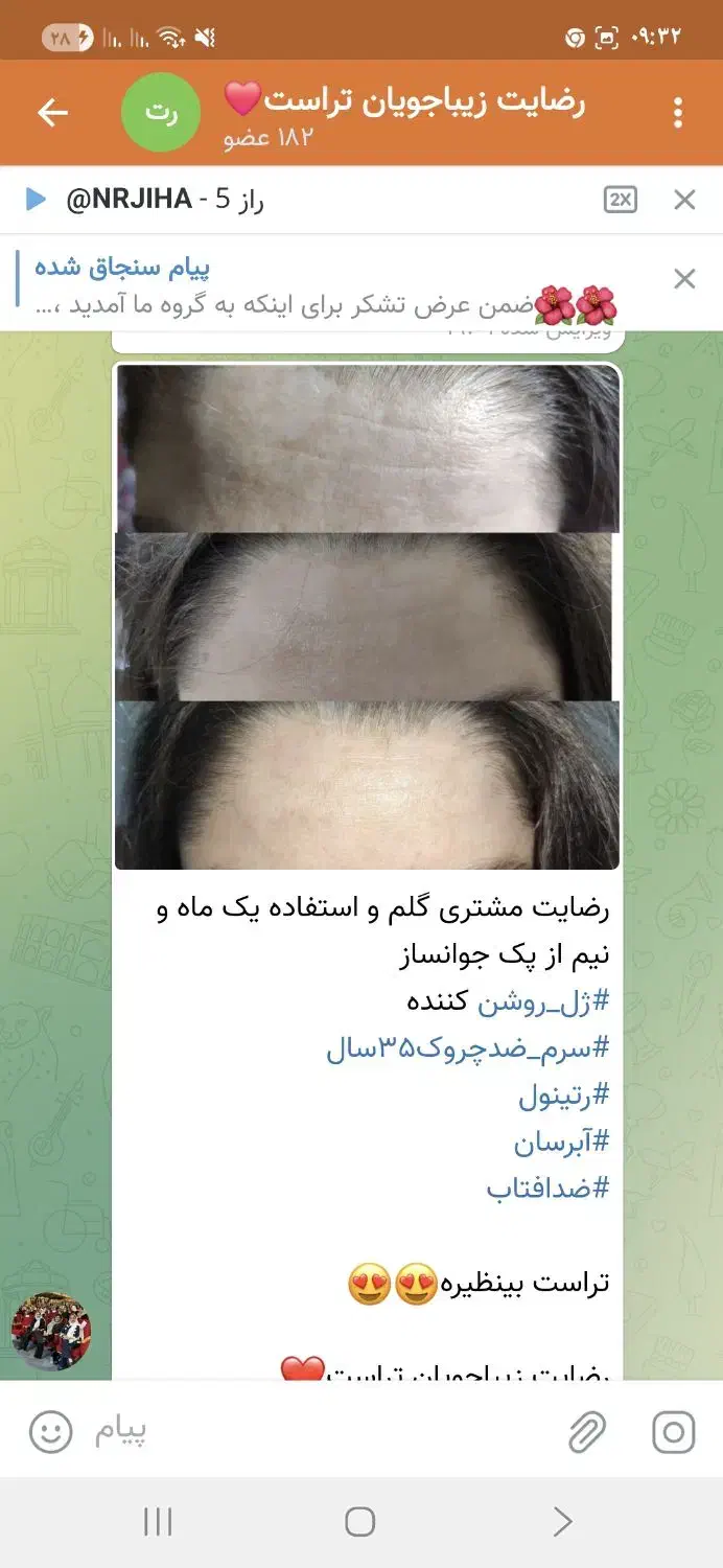 محصولات جوانساز ضد چین وچروک|آرایشی، بهداشتی، درمانی|تهران, الهیه|دیوار