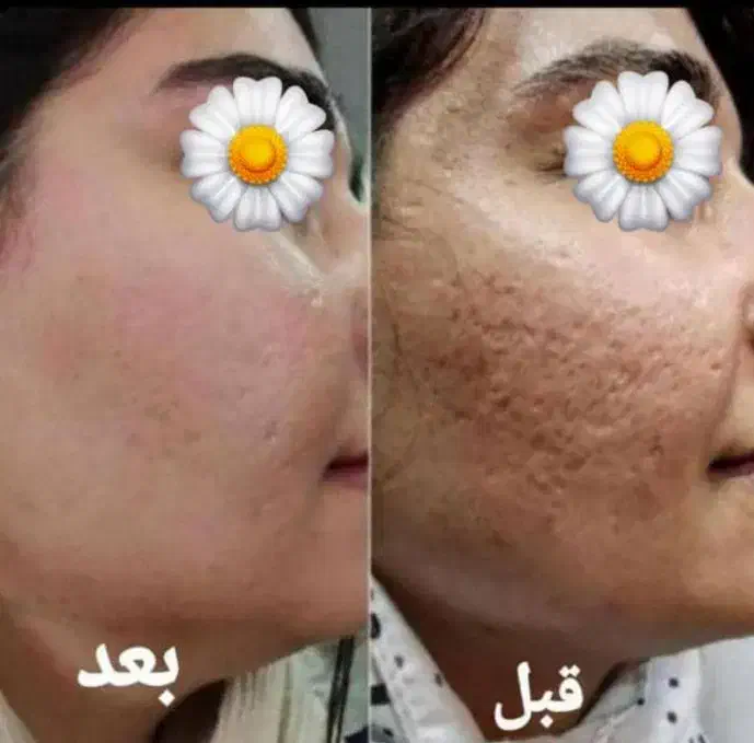 کرم Vip معجزه|آرایشی، بهداشتی، درمانی|یاسوج, |دیوار