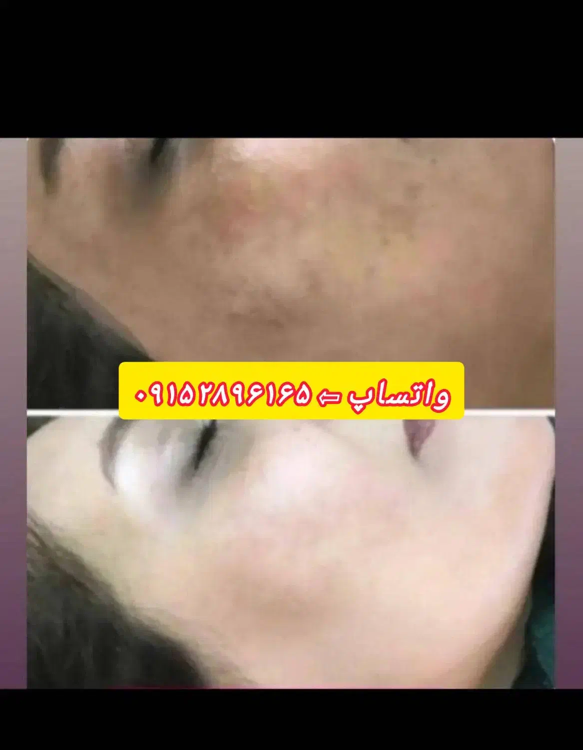 مورفین سلامت و زیبایی پوست|آرایشی، بهداشتی، درمانی|سیب و سوران, |دیوار