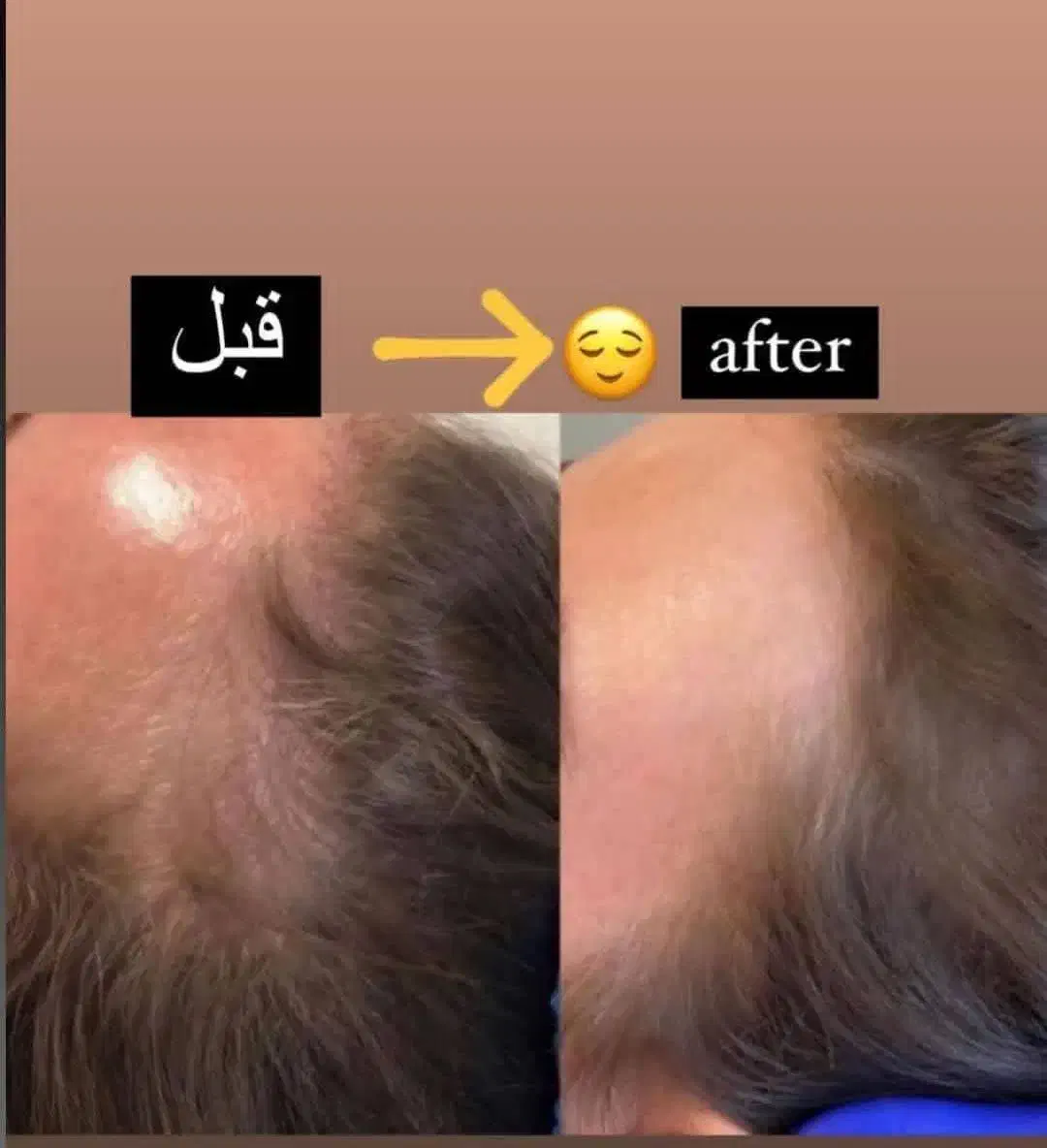 مشاور پوست و مو لیاتیم|آرایشی، بهداشتی، درمانی|اصفهان, باغ زرشک|دیوار