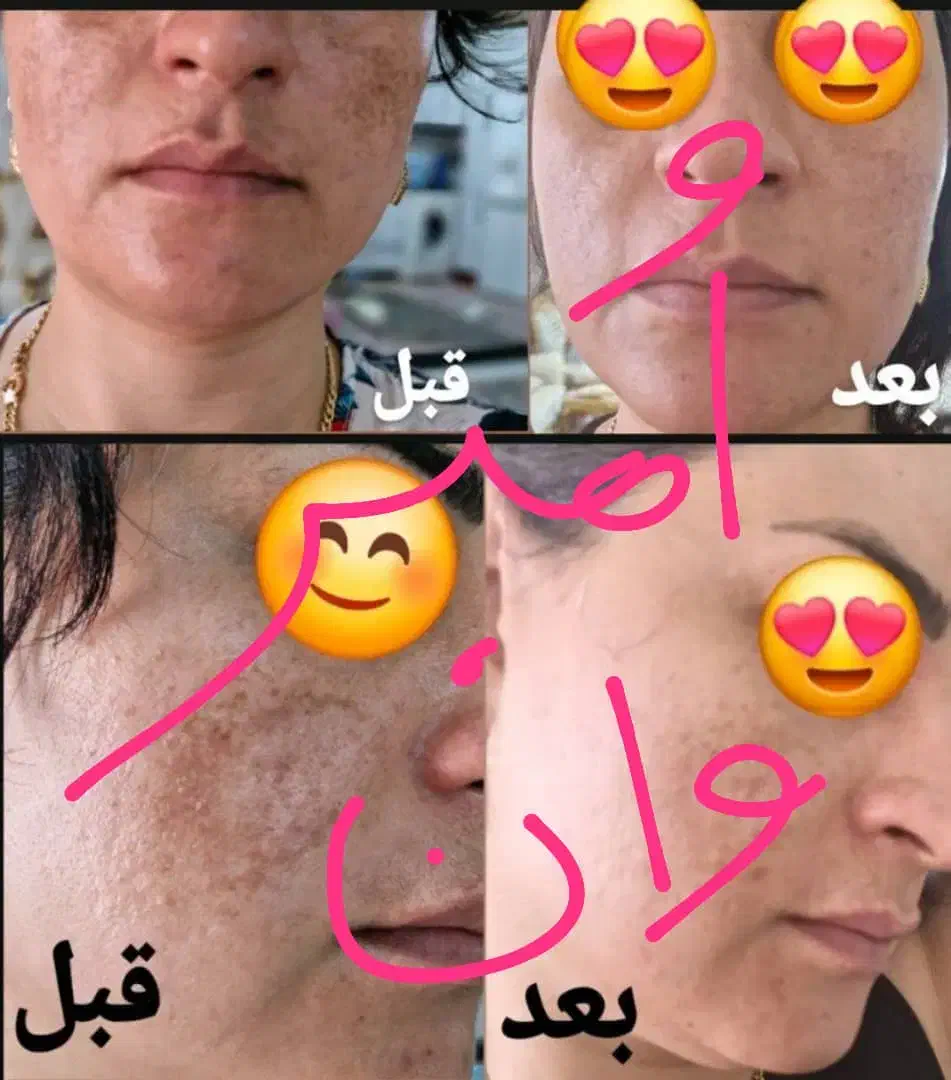 کرم صورت|آرایشی، بهداشتی، درمانی|شیراز, پانصد دستگاه ارتش|دیوار