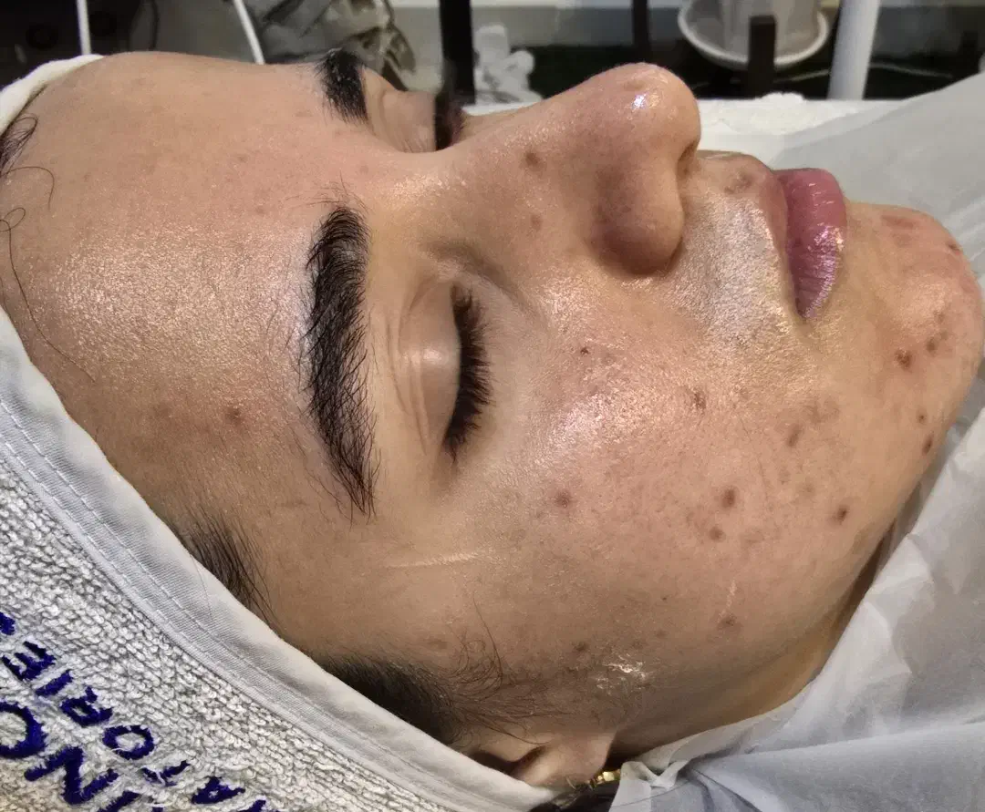 آموزش تخصصی فیشال و پاکسازی پوست|خدمات آموزشی|ارومیه, |دیوار