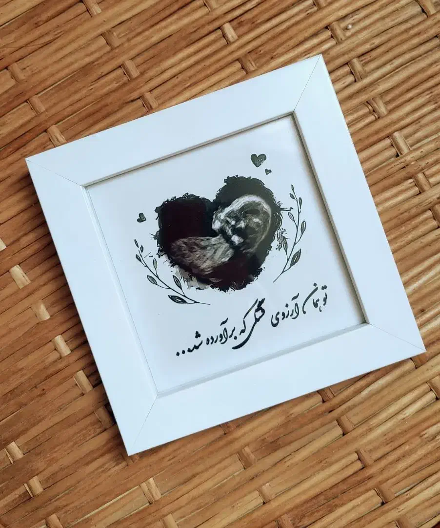 قاب عکس سونوگرافی|تابلو، نقاشی، عکس|مشهد, ایثارگران|دیوار