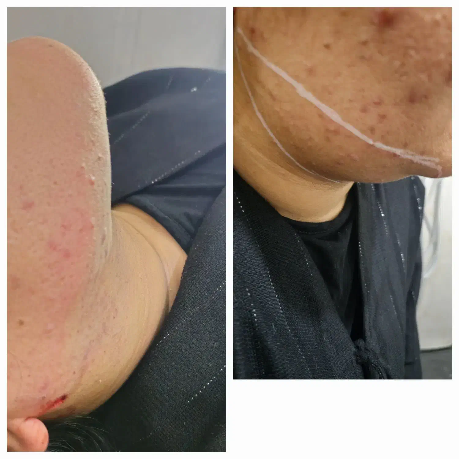 ژل بوتاکس بلفارو پلاستی لیزر|خدمات آرایشگری و زیبایی|اهواز, اهواز|دیوار