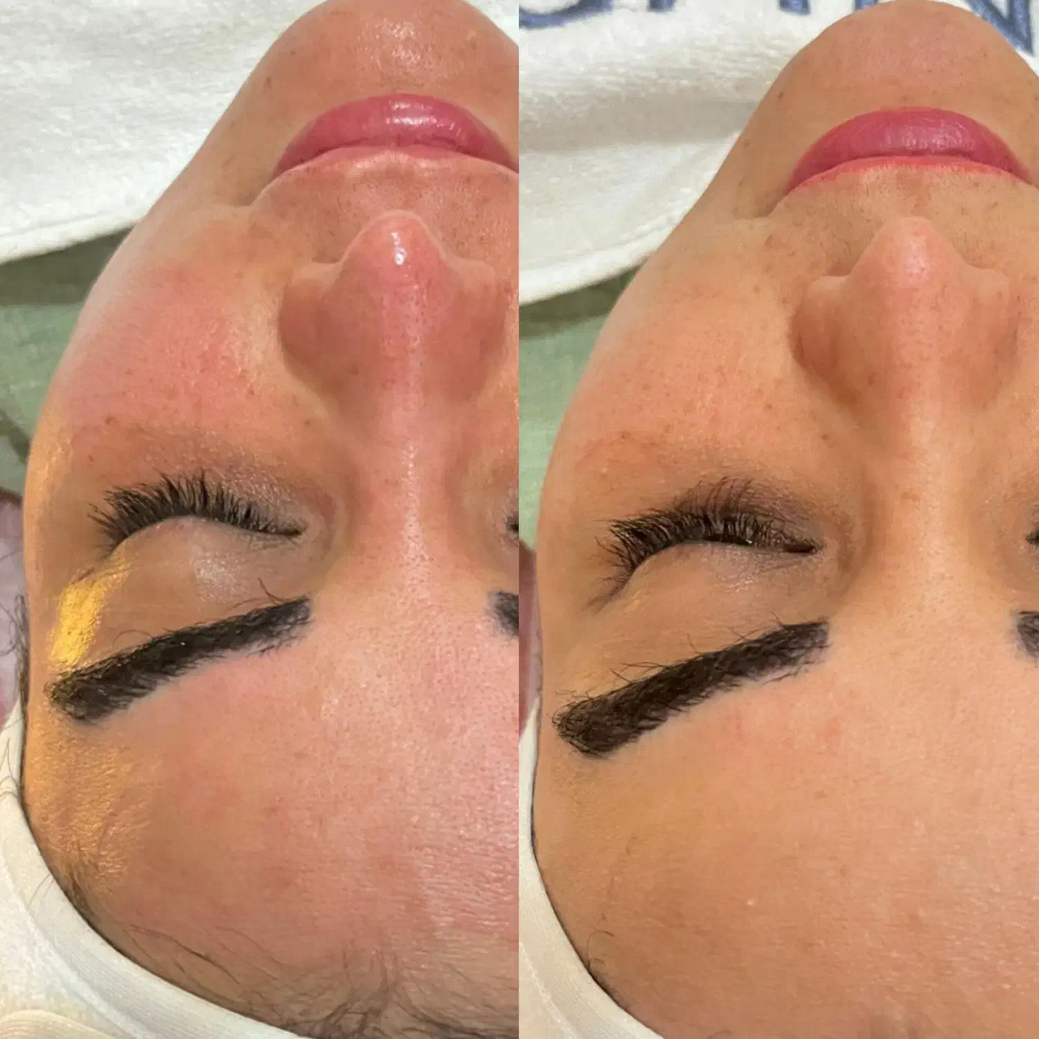 جشنواره خدمات کلینیک زیبایی|خدمات آرایشگری و زیبایی|تبریز, |دیوار