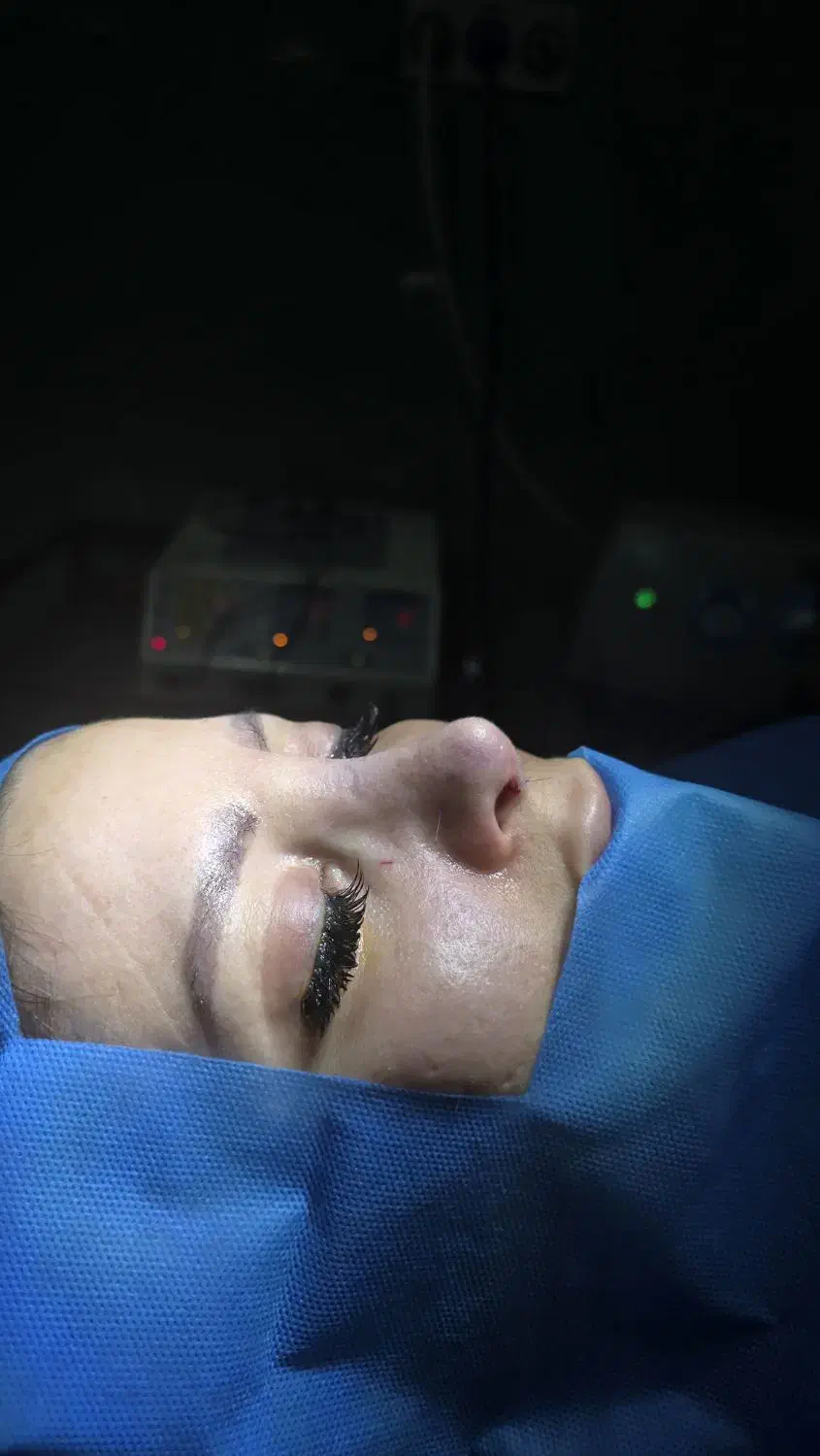 بینی بلفارو غبغب بوتاکس فیلر بادی بیکینی مامو|خدمات آرایشگری و زیبایی|تهران, نیاوران|دیوار