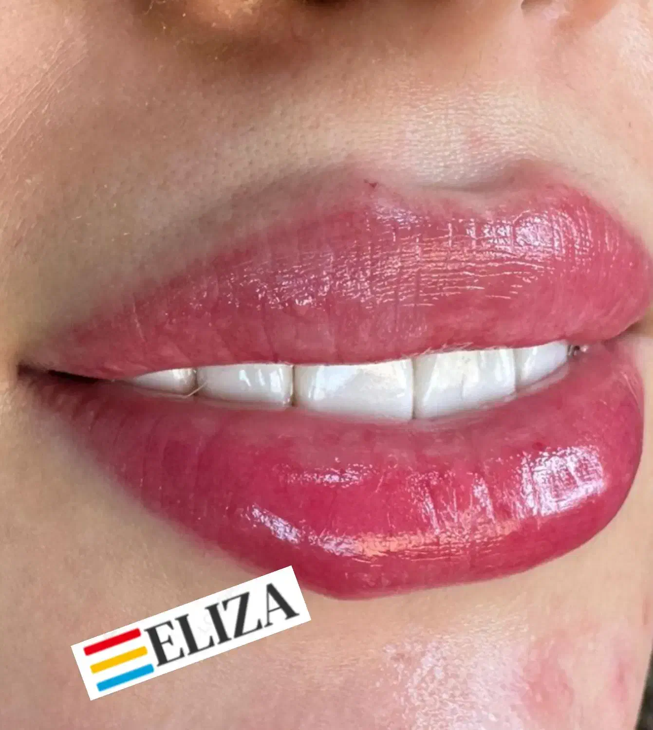 استخدام منشی کلینیک زیبایی|استخدام درمانی، زیبایی، بهداشتی|ری, اقدسیه|دیوار