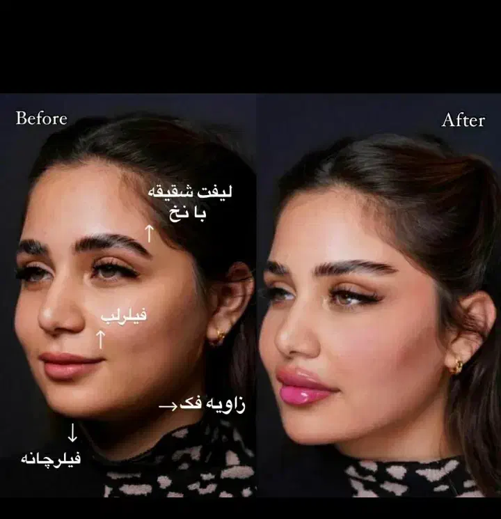 مطب زیبایی تپش .جشنواره تخفیف/لیزر/ژل بوتاکس|خدمات آرایشگری و زیبایی|گلبهار, شهر جدید گلبهار|دیوار