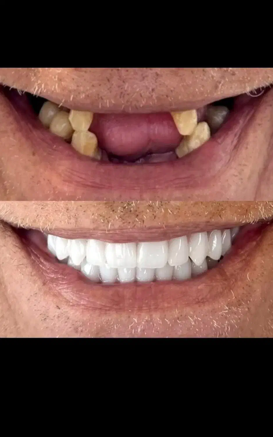 تخفیف کامپوزیت لمینت با اقساط|خدمات آرایشگری و زیبایی|قم, مهدیه|دیوار